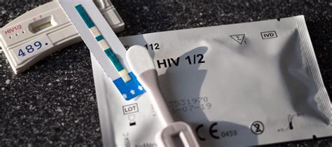 hiv-test für schwule